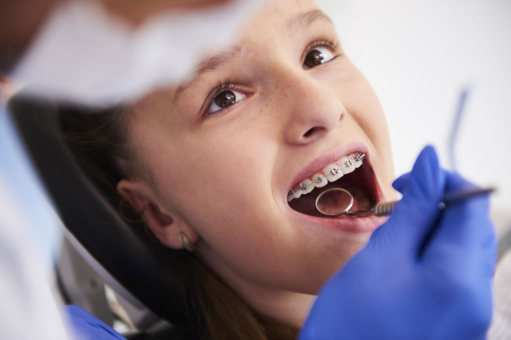 I vantaggi dell’ortodonzia tradizionale e invisibile per i bambini